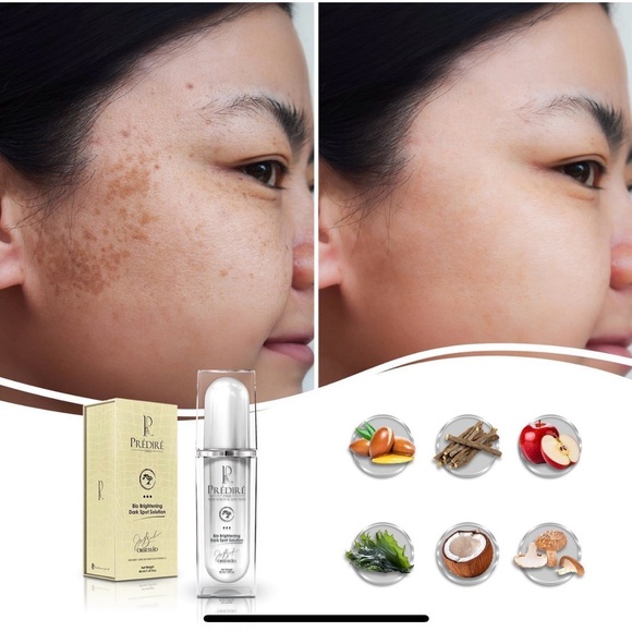 ✨ Prédiré Paris Bio Brightening Dark Spot Solution 40 ml / 1.35 fl oz – Sealed - Picture 3 of 8